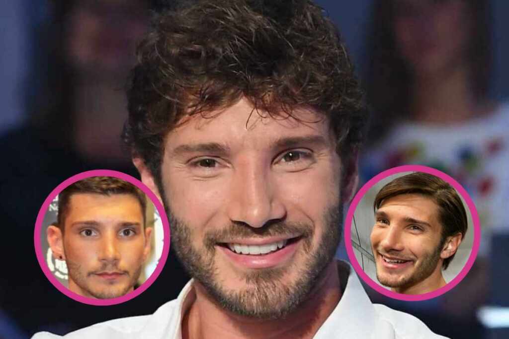 Stefano De Martino Tutto Rifatto Ma Che Ritocchini Ha Fatto Ecco