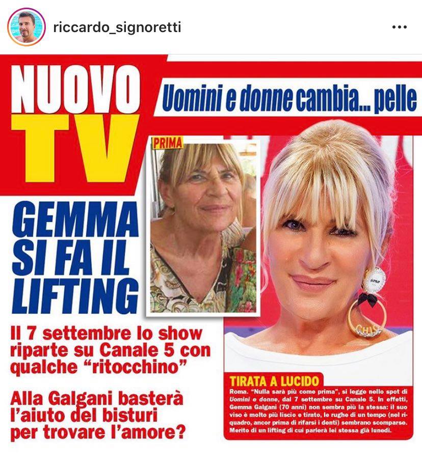 Gemma Galgani prima e dopo il lifting