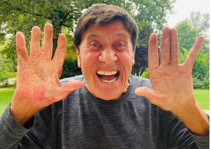 gianni morandi mano bruciata