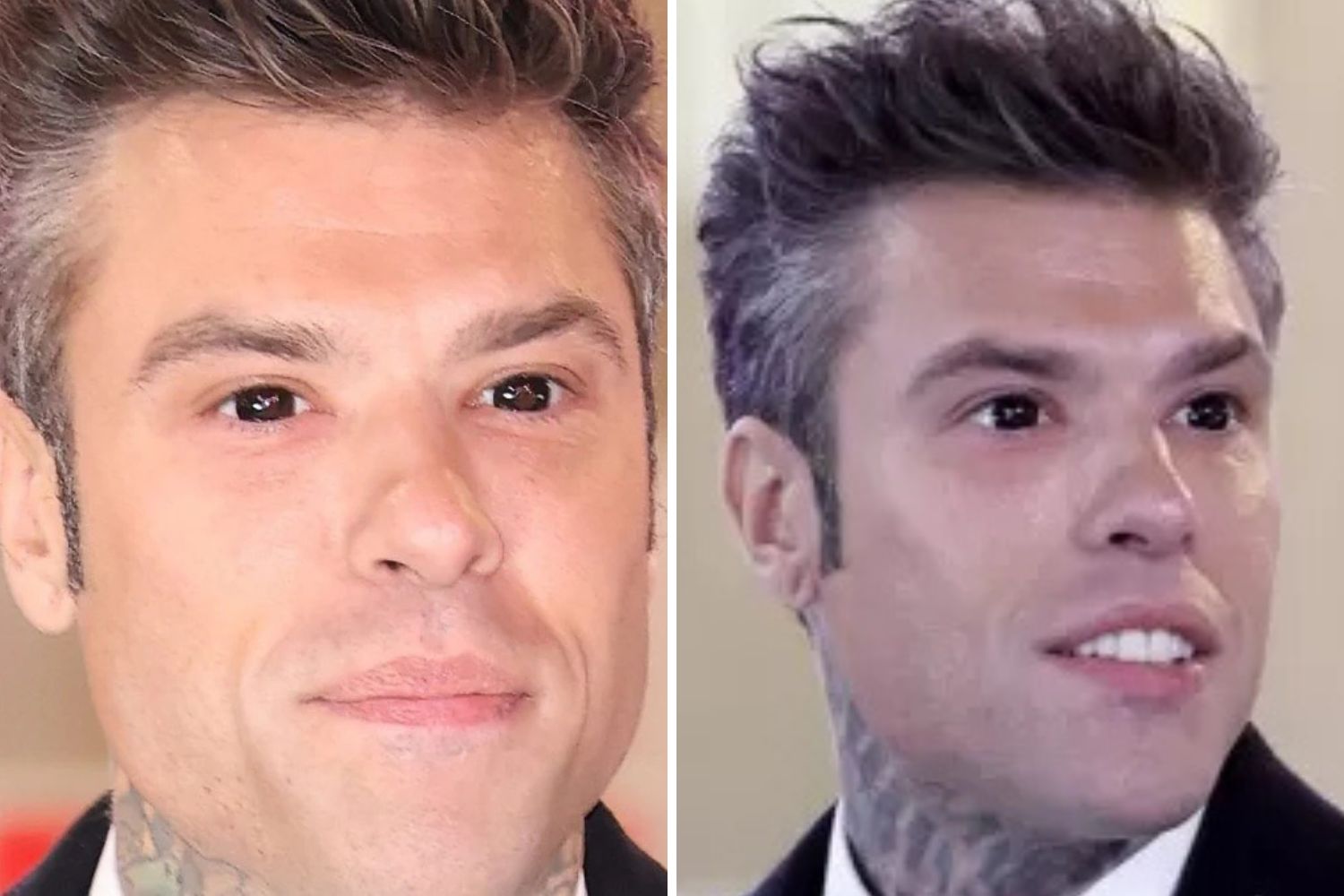 Fedez con gli occhi strani a Sanremo? L’ennesima trovata ridicola per far parlare di sé: ecco la verità